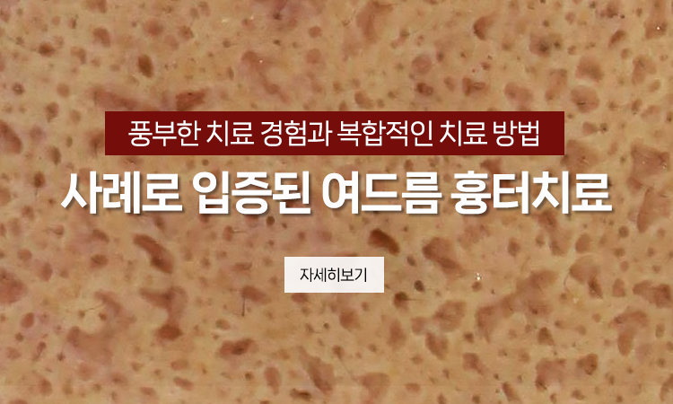 여드름흉터치료