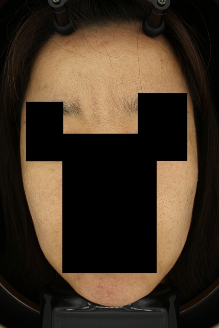 치료후기 이미지