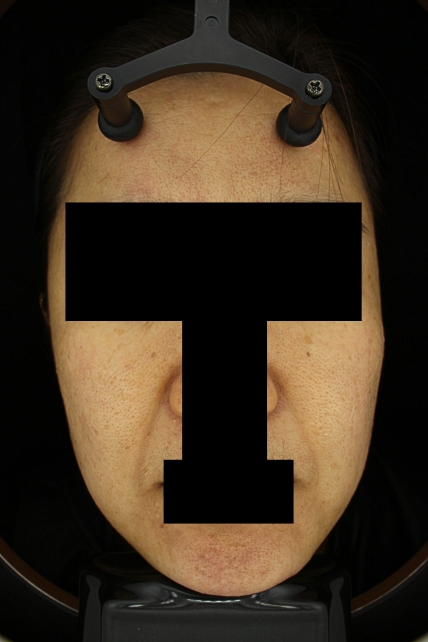 치료후기 이미지