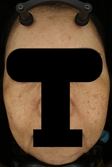 치료후기 이미지