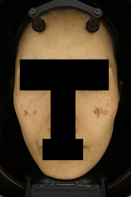 치료후기 이미지