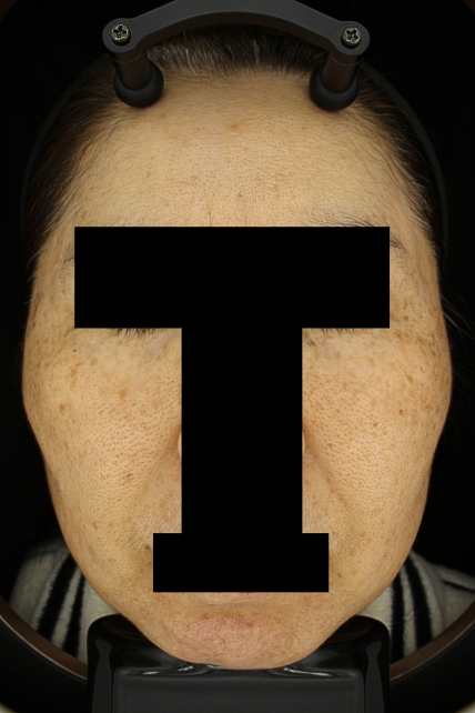 치료후기 이미지