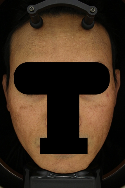 치료후기 이미지