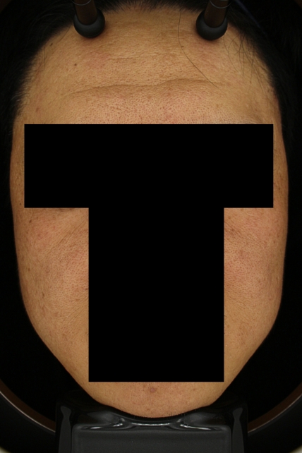 치료후기 이미지