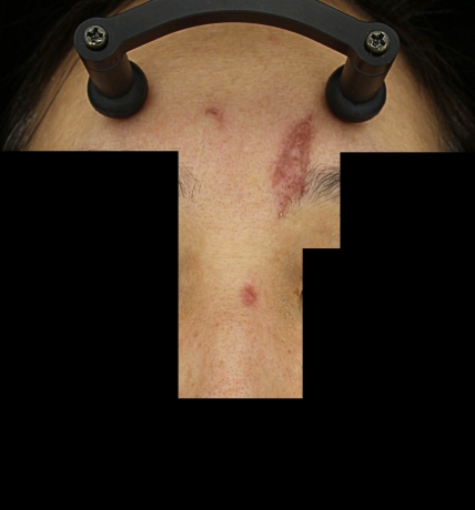 치료후기 이미지