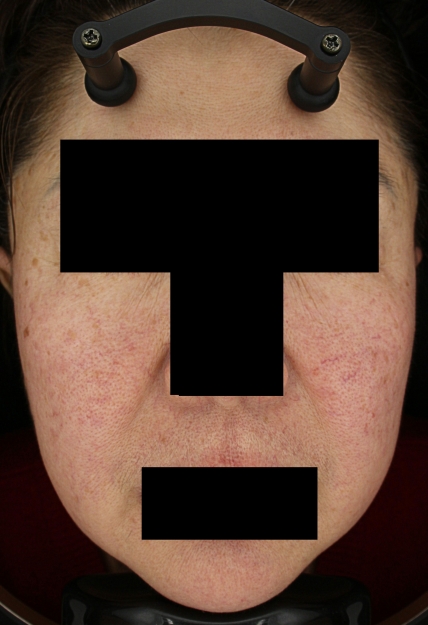 치료후기 이미지