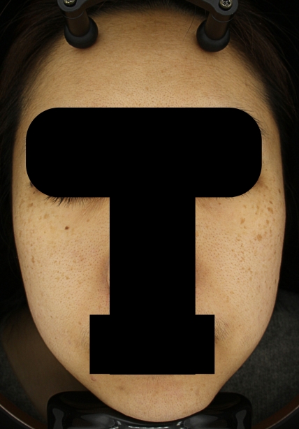 치료후기 이미지