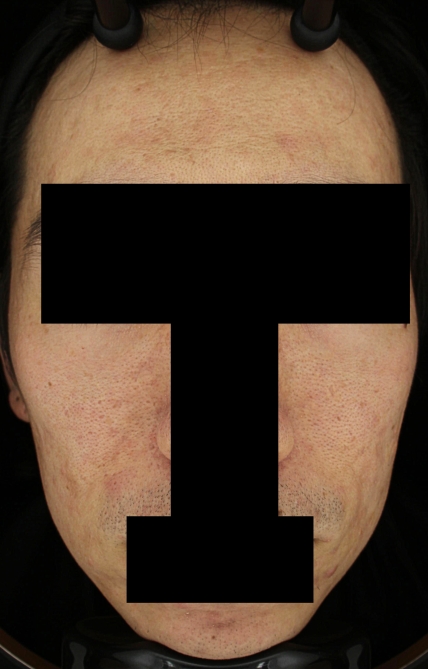 치료후기 이미지