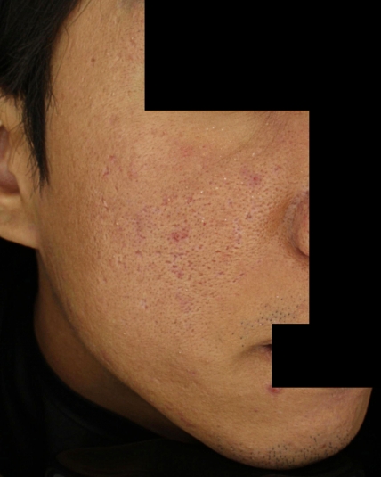 치료후기 이미지