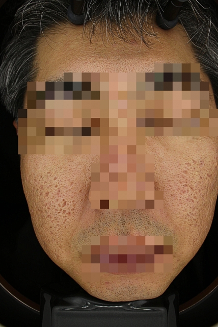 치료후기 이미지