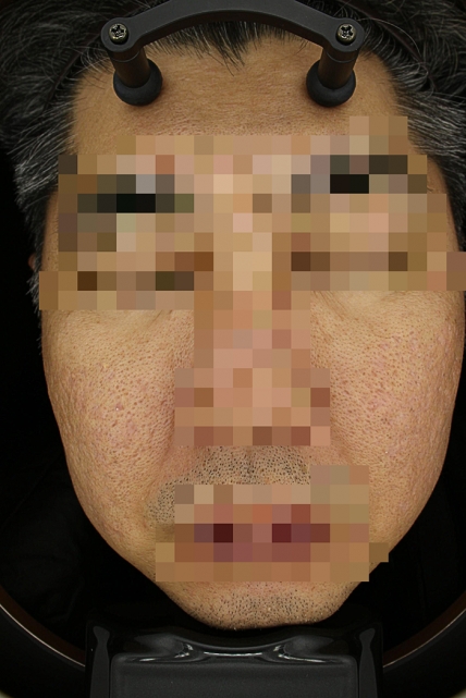 치료후기 이미지