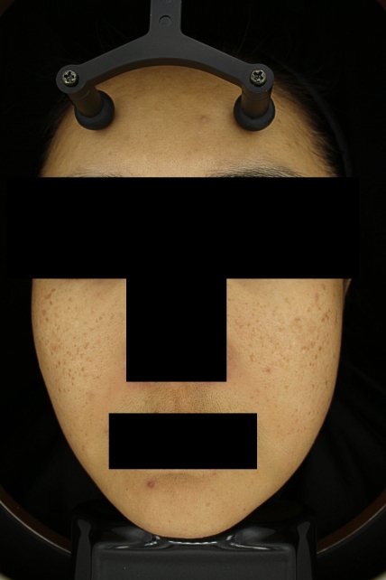 치료후기 이미지