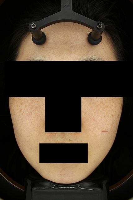 치료후기 이미지