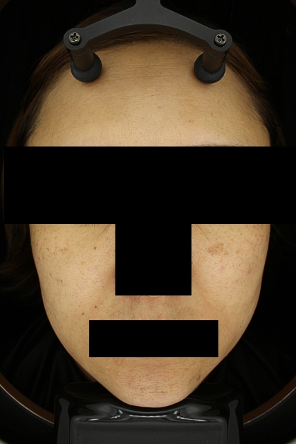 치료후기 이미지