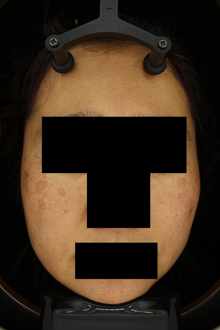 치료후기 이미지