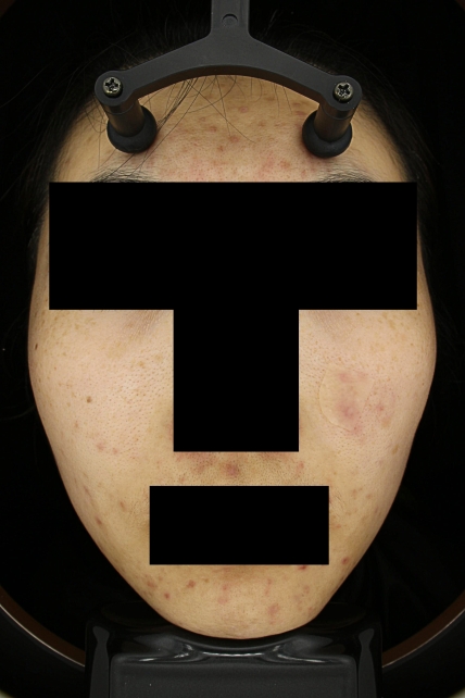 치료후기 이미지