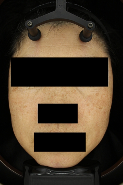 치료후기 이미지