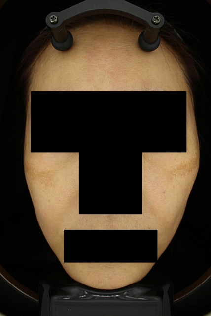 치료후기 이미지