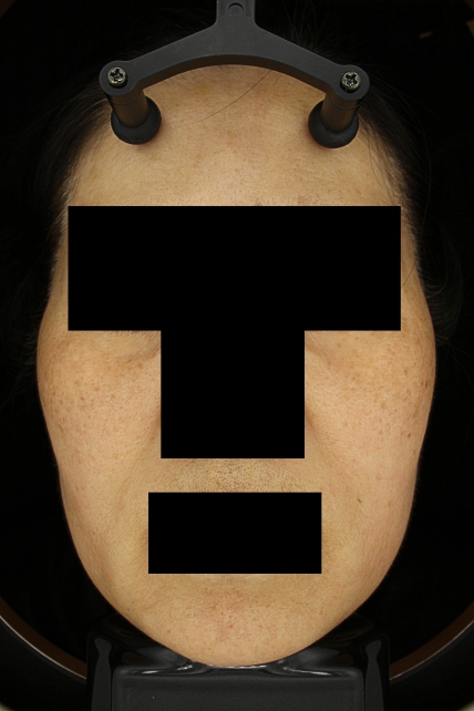 치료후기 이미지