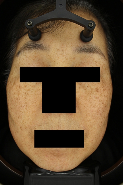 치료후기 이미지