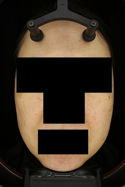 치료후기 이미지