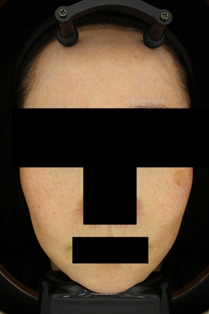 치료후기 이미지