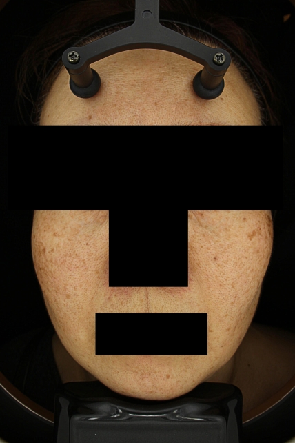 치료후기 이미지