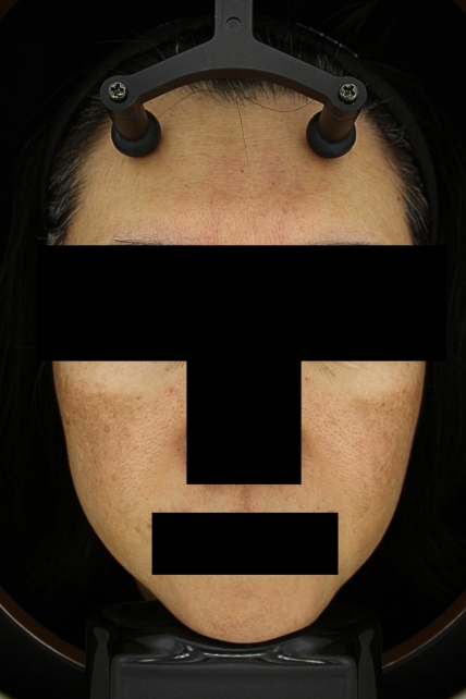 치료후기 이미지