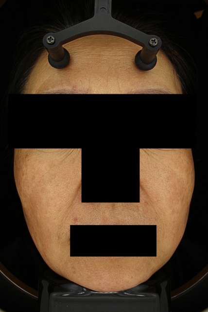 치료후기 이미지