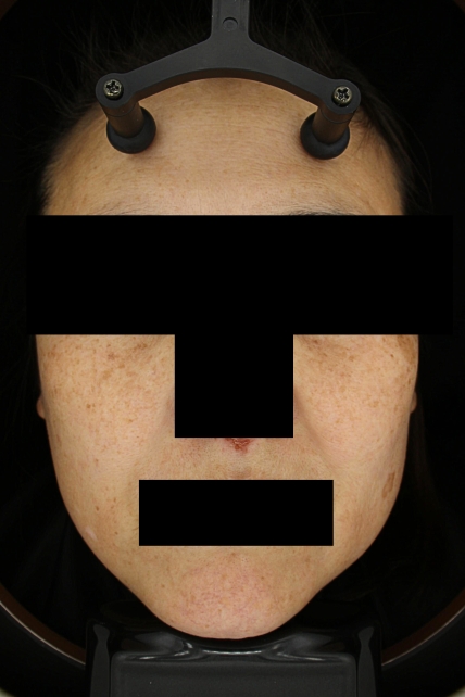 치료후기 이미지