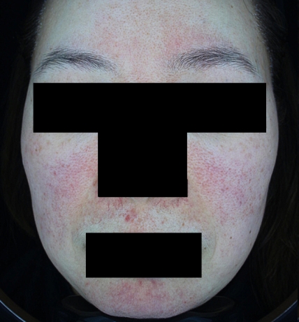 치료후기 이미지