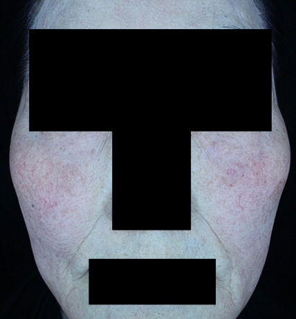 치료후기 이미지