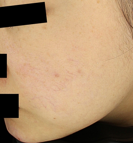 치료후기 이미지