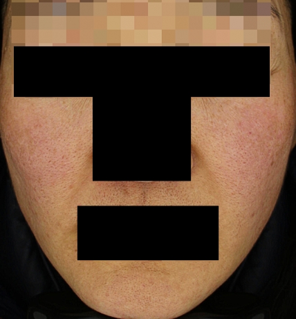 치료후기 이미지