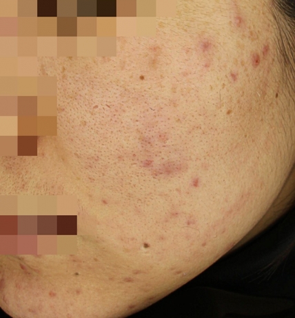 치료후기 이미지