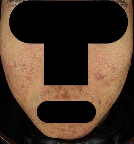 치료후기 이미지