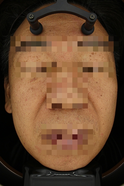 치료후기 이미지