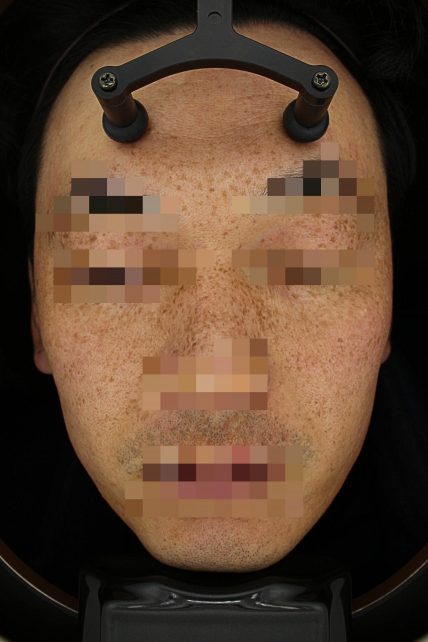 치료후기 이미지