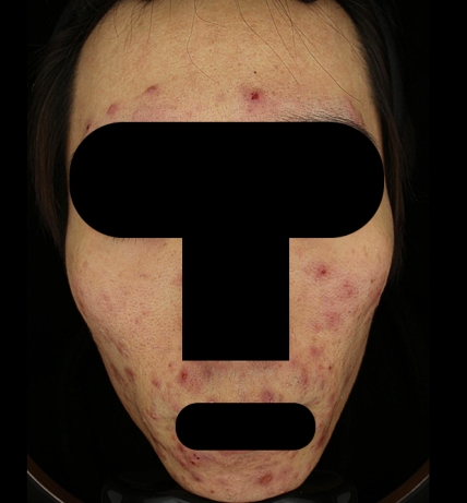 치료후기 이미지