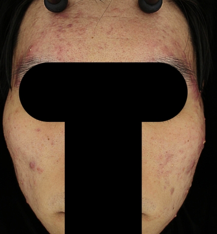 치료후기 이미지