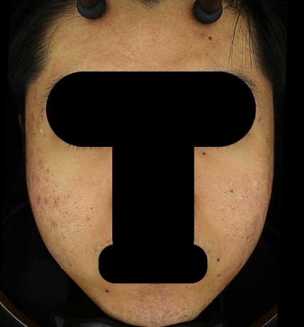 치료후기 이미지