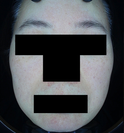 치료후기 이미지