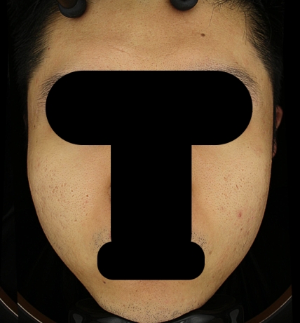 치료후기 이미지