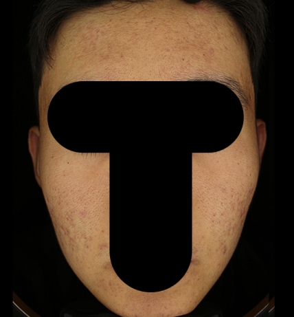 치료후기 이미지