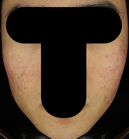 치료후기 이미지