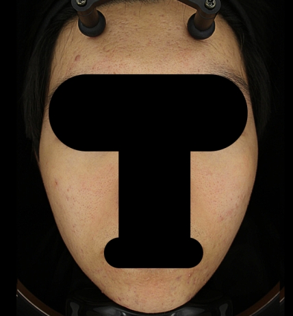 치료후기 이미지