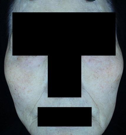 치료후기 이미지