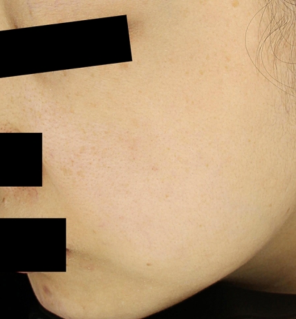 치료후기 이미지