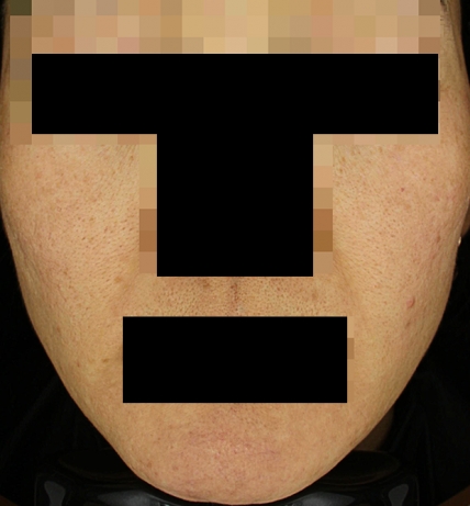 치료후기 이미지