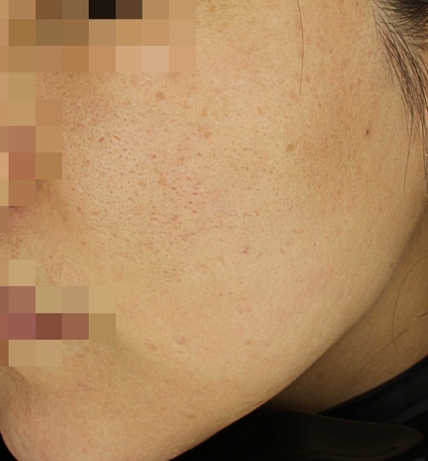 치료후기 이미지